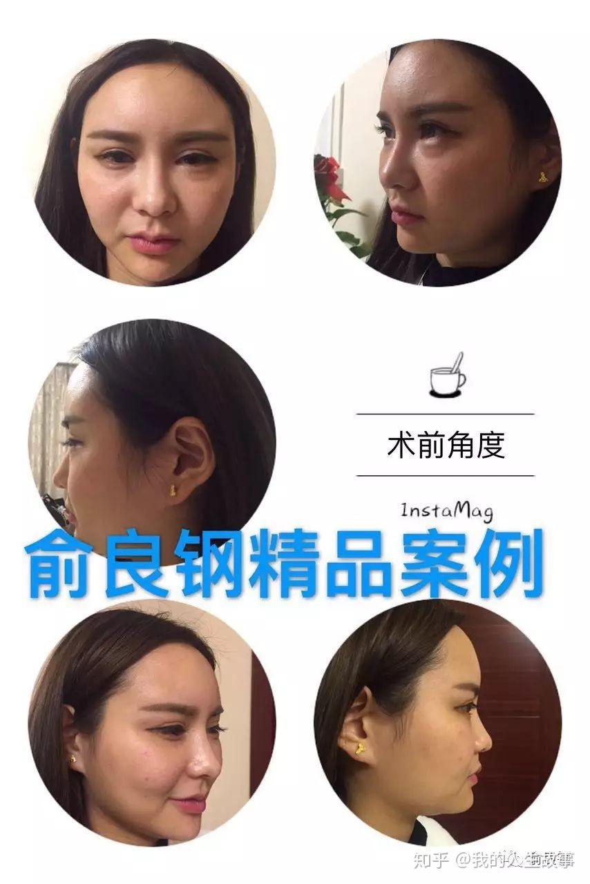 企业信用修复磨骨修复知乎(磨骨修整要多少钱)