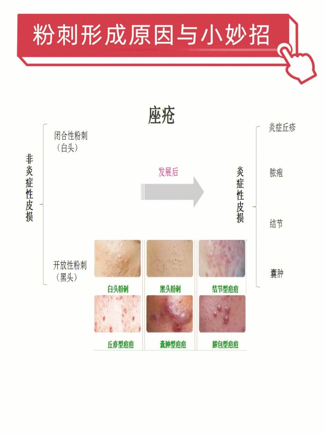 企业信用修复如何根源性的抹除公司的负面信息(如何根源性的抹除公司的负面信息呢)
